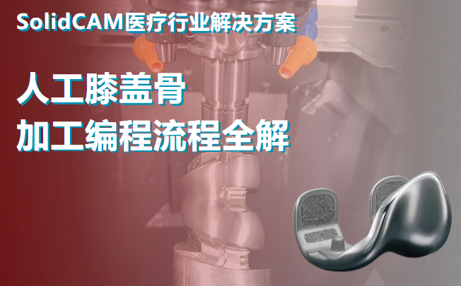 SolidCAM 医疗行业解决方案 | 人工膝盖骨加工编程流