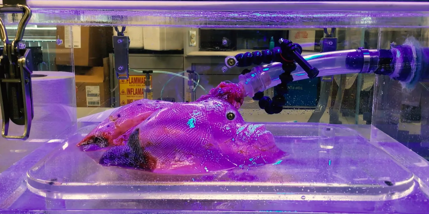 解读肺部复杂性