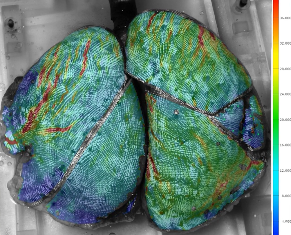 分析肺部行为 分析肺部行为