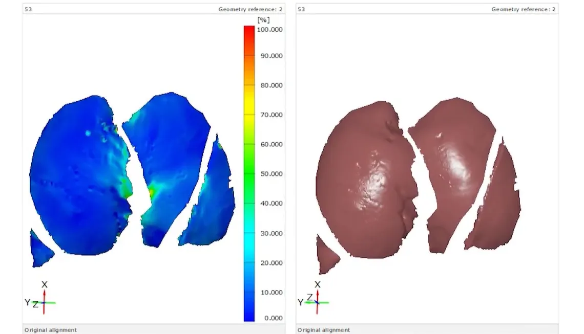 通过SIMULIA模拟为肺部研究注入新活力